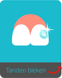 Tanden-bleken